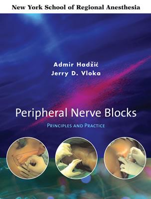 Peripheral Nerve Blocks: Principles and Practice - Hadzic, Admir, MD (Editor), and Vloka Jerry, and Vloka, Jerry (Editor)