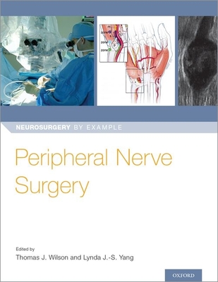 Peripheral Nerve Surgery - Wilson, Thomas (Editor), and Yang, Lynda J (Editor)
