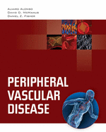 Peripheral Vascular Disease: .