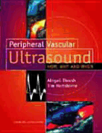 Peripheral Vascular Ultrasound: How, Why and When