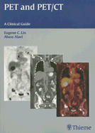 PET and PET/CT: A Clinical Guide