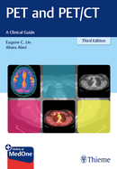 Pet and Pet/CT: A Clinical Guide