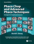 Phaco Chop and Advanced Phaco Techniques: Strategies for Complicated Cataracts