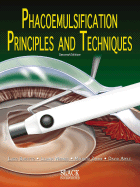 Phacoemulsification: Principles and Techniques