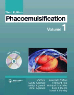 Phacoemulsification