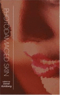 Photodamaged Skin
