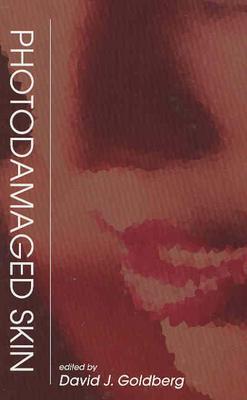 Photodamaged Skin - Goldberg, David J (Editor)