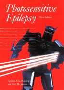 Photosensitive epilepsy