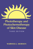 Phototherapy and Photochemotherapy for Skin Disease
