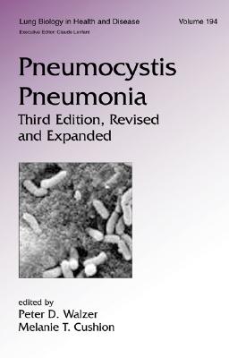 Pneumocystis Pneumonia - Walzer, Peter (Editor), and Cushion, Melanie T (Editor)