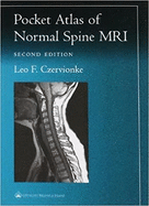 Pocket Atlas of Spinal MRI