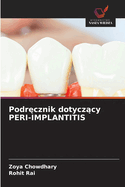 Podr cznik dotycz cy PERI-IMPLANTITIS