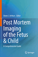Post Mortem Imaging of the Fetus & Child: A Comprehensive Guide