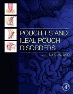 Pouchitis and Ileal Pouch Disorders: A Multidisciplinary Approach for Diagnosis and Management