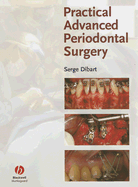 Practical Advanced Periodontal Surgery