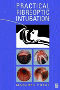 Practical Fibreoptic Intubation