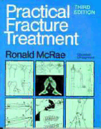 Practical Fracture Treatment
