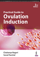 Practical Guide to Ovulation Induction