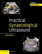 Practical Gynaecological Ultrasound