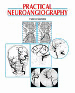 Practical Neuroangiography