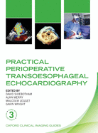 Practical Perioperative Transoesophageal Echocardiography
