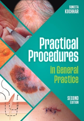 Practical Procedures in General Practice, second edition - Kochhar, Suneeta