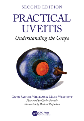 Practical Uveitis: Understanding the Grape - Williams, Gwyn Samuel, and Westcott, Mark