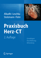Praxisbuch Herz-CT: Grundlagen - Durchfuhrung - Befundung