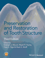 Preservation and Restoration of Tooth Structure