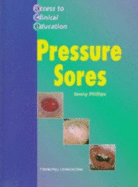Pressure Ulcers - Phillips, Jenny, RGN