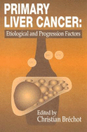 Primary Liver Cancer: Etiological and Progression Factors