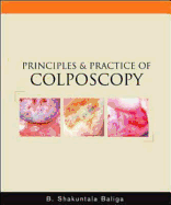 Principles and Practice of Colposcopy