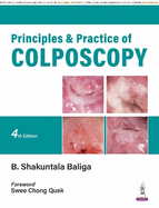 Principles and Practice of Colposcopy