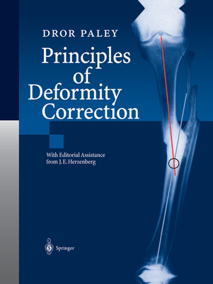 Principles of Deformity Correction - Herzenberg, J.E. (Assisted by), and Paley, Dror