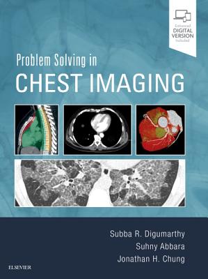 Problem Solving in Chest Imaging - Digumarthy, Subba R., MD, and Abbara, Suhny, MD, FACR, and Chung, Jonathan H., MD
