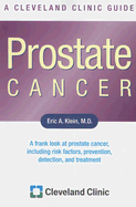 Prostate Cancer: A Cleveland Clinic Guide