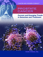 Prostate Cancer