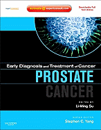 Prostate Cancer