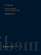 Protein Expression in Down Syndrome Brain