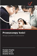 Przeszczepy ko ci