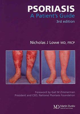 Psoriasis: A Patient's Guide, Third Edition - Lowe, Nicholas J, MD
