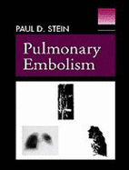 Pulmonary Embolism