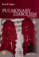 Pulmonary Embolism