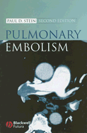 Pulmonary Embolism