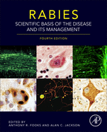 Rabies: Scientific Basis of the Disease and Its Management