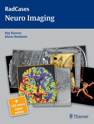 Radcases Neuro Imaging - Riascos-Castaneda, Roy F (Editor), and Bonfante, Eliana (Editor)