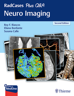 Radcases Plus Q&A Neuro Imaging - Riascos-Castaneda, Roy F (Editor), and Bonfante, Eliana (Editor), and Calle, Susana (Editor)