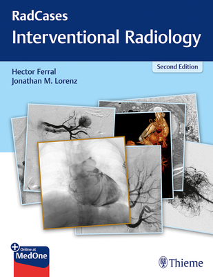Radcases Q&A Interventional Radiology - Ferral, Hector, and Lorenz, Jonathan M