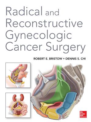 Radical and Reconstructive Gynecologic Cancer Surgery - Chi, Dennis, and Bristow, Robert