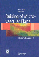 Raising of Microvascular Flaps: A Systematic Approach